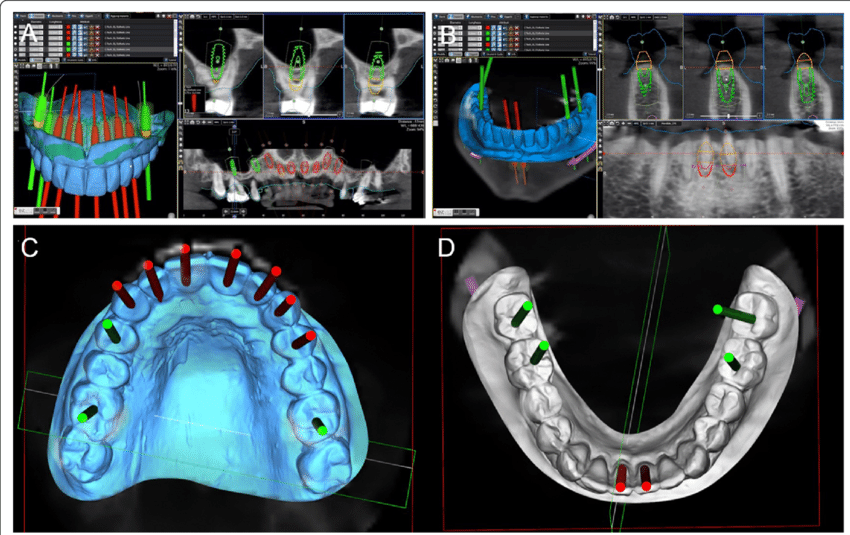 3d dental surgery