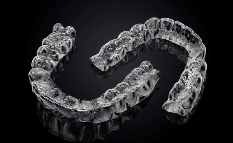 clear aligners at Dental trust