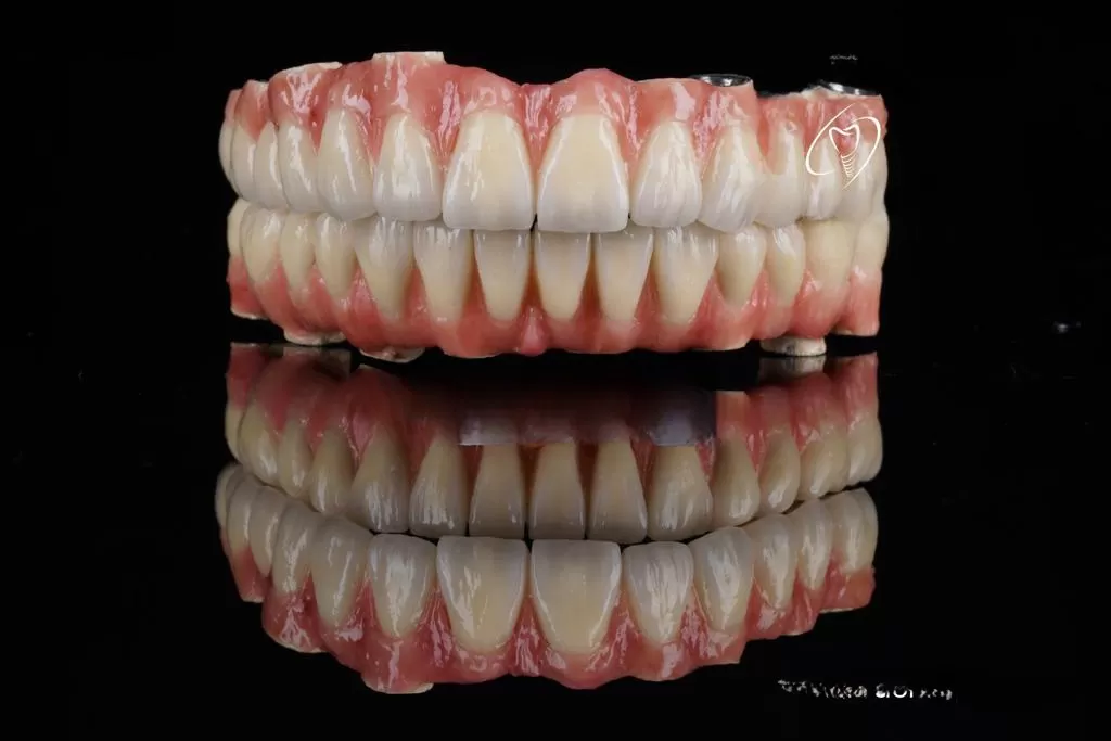 best 3d guided dental implants