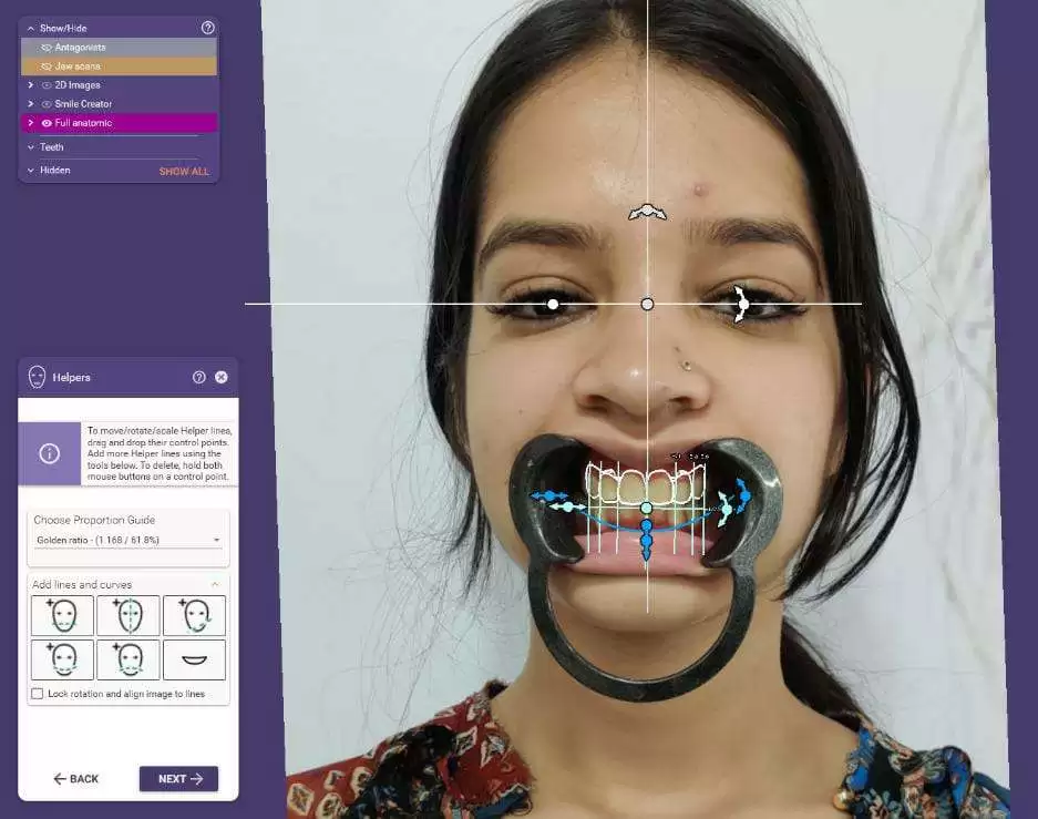 best digital smile designing.